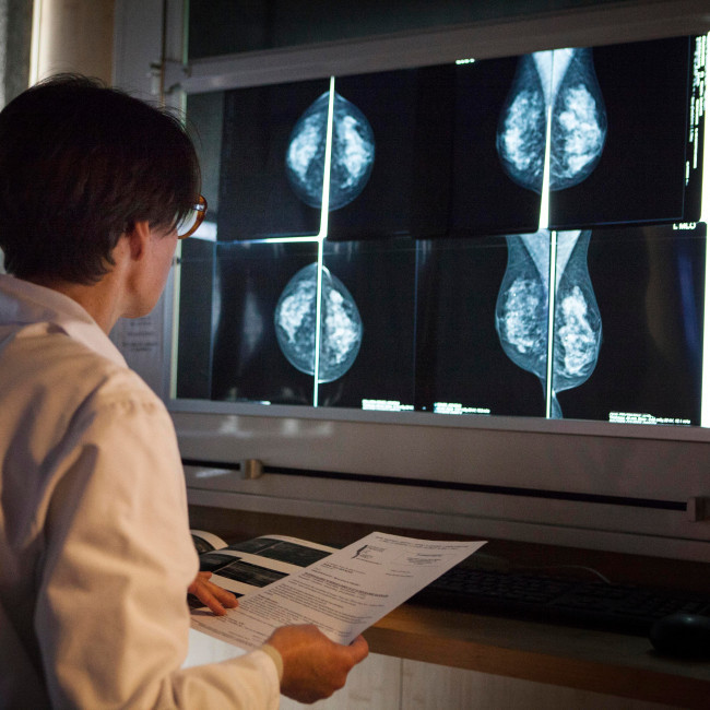 Study finds that AI can detect heart disease in women using mammograms